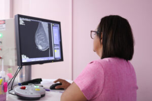 Imagem da notícia - Mamografia é essencial para o diagnóstico precoce do câncer de mama, destaca FCecon