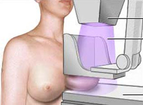 Imagem da notícia - Coordenação de Atenção Oncológica estima que sejam realizadas 45 mil mamografias no Estado em 2012