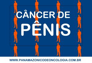 Imagem da notícia - Pesquisa associando o HPV ao câncer de pênis será apresentada no Pan Amazônico de Oncologia