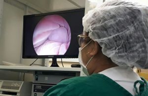 Endoscopia foto