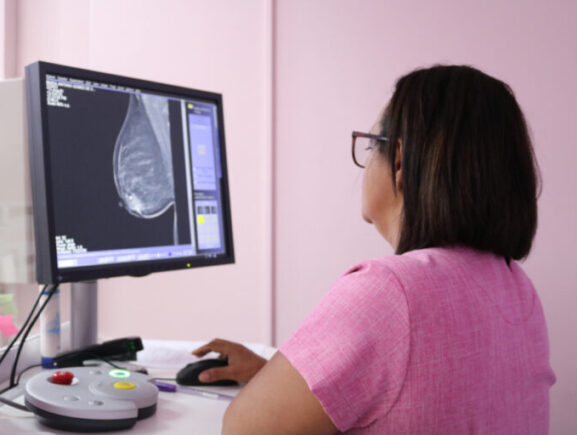 FCecon alerta que são estimados 15 mil novos casos de câncer para o triênio 2023-2025