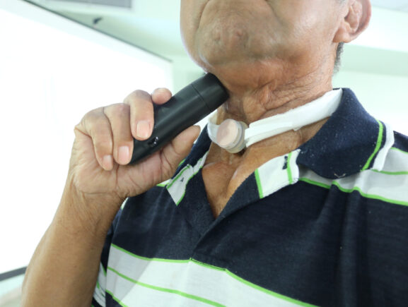 Pacientes da FCecon recebem laringe eletrônica para auxiliar na fala